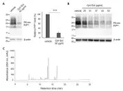 Pharmaceutical composition comprising furanodienone derived from Curcuma phaeocaulis Valeton (Zingiberaceae) for prion diseases caused by protein aggregation Representative drawing
